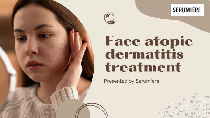 face atopic dermatitis treatment