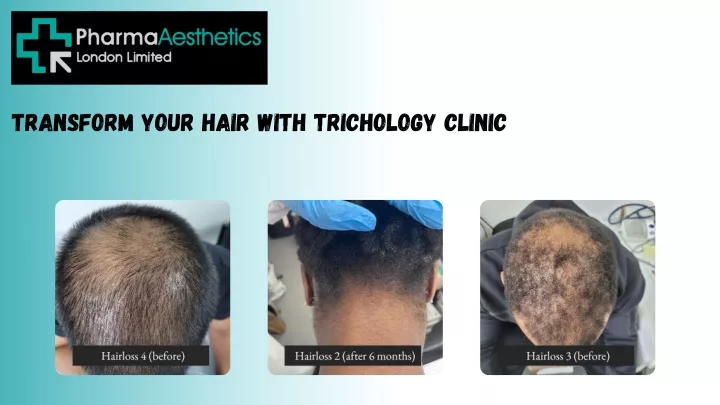 transform your hair with trichology clinic