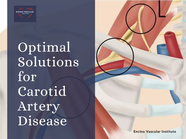 optimal solutions for carotid artery disease