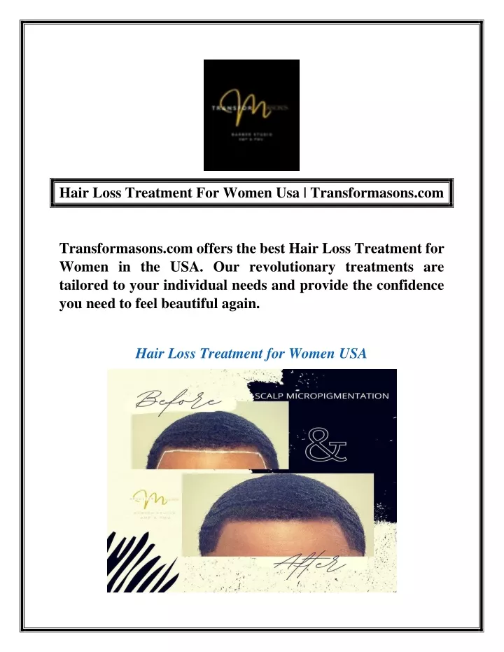 hair loss treatment for women usa transformasons