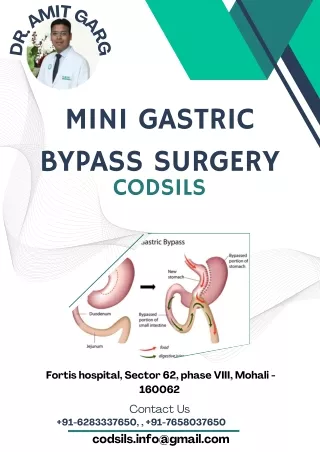 Unveiling Weight Loss Triumph: Mini Gastric Bypass Surgery