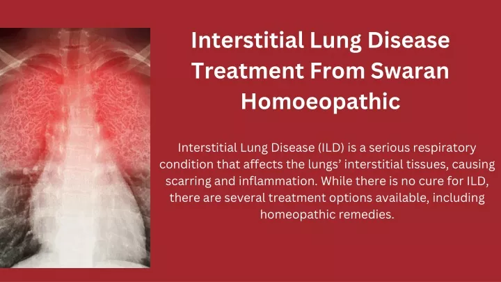 interstitial lung disease treatment from swaran
