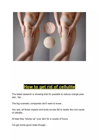 How to get rid of cellulite