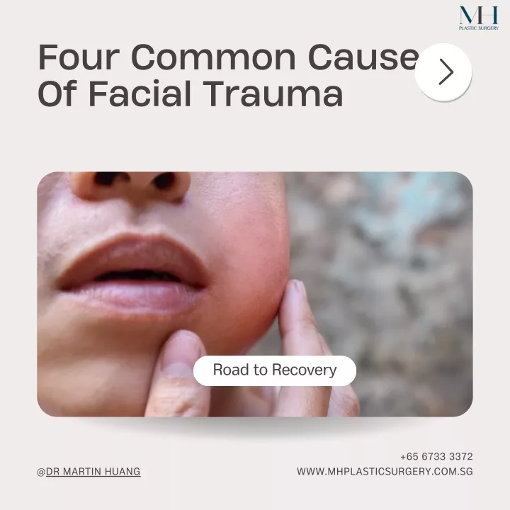 four common causes of facial trauma