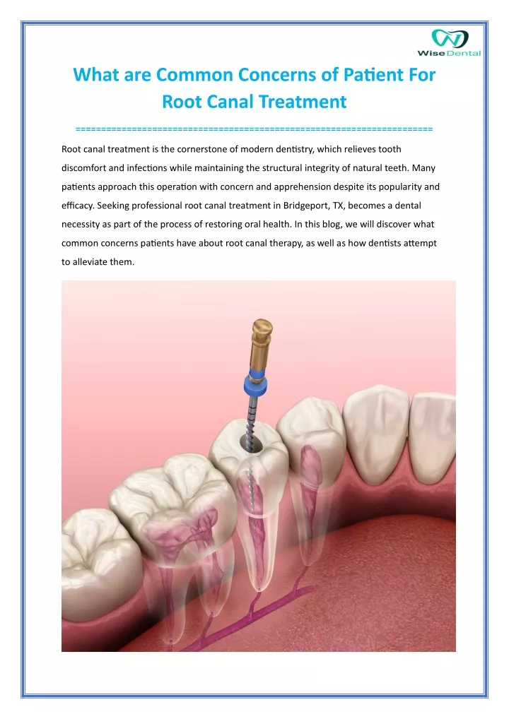 what are common concerns of patient for root