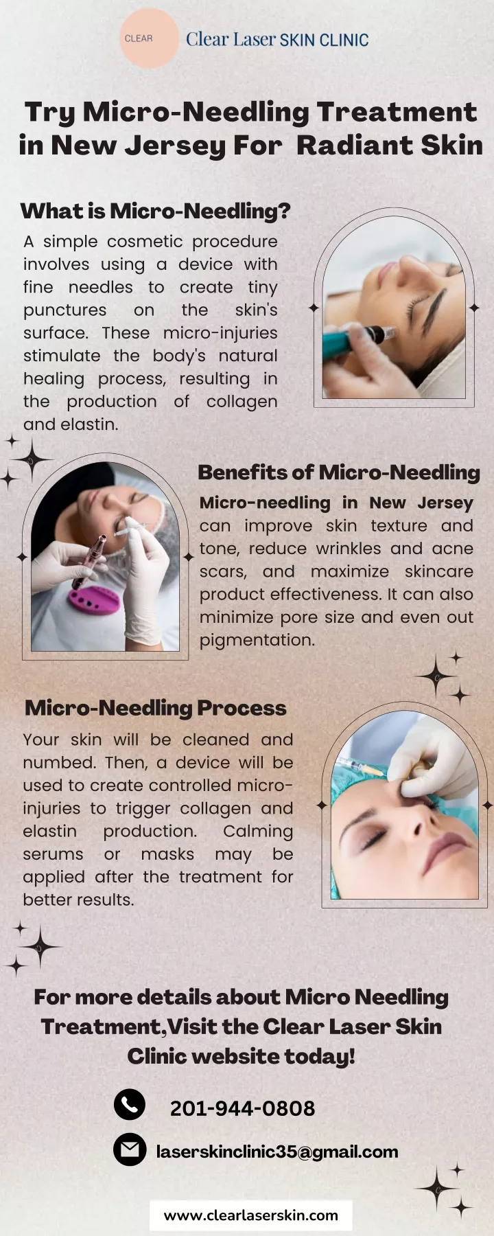 try micro needling treatment in new jersey