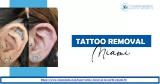 Elite Tattoo Removal Solutions in Miami | Comprehensive Medical Aesthetics