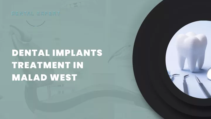dental implants treatment in malad west