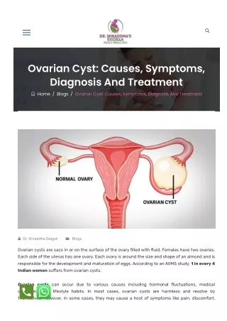 Ovarian Cyst Causes Symptoms Diagnosis And Treatment