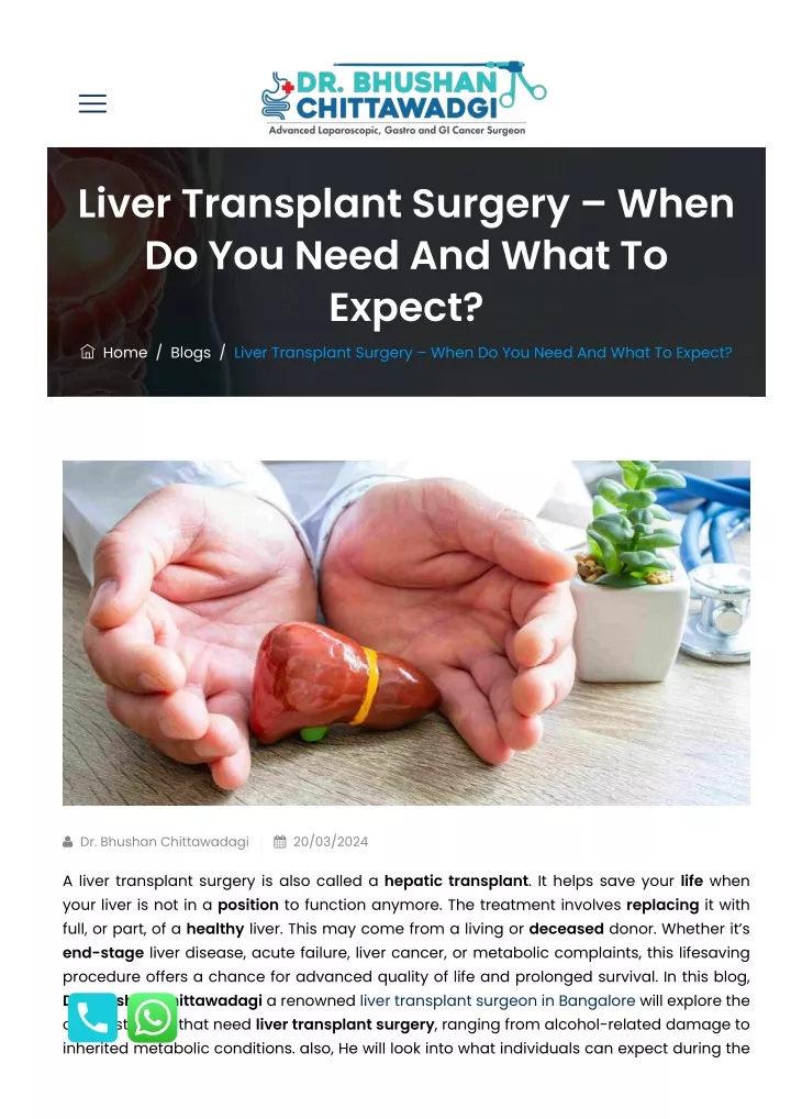 liver transplant surgery when do you need