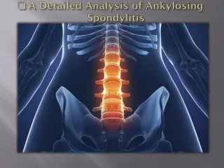 .A Detailed Analysis of Ankylosing Spondylitis