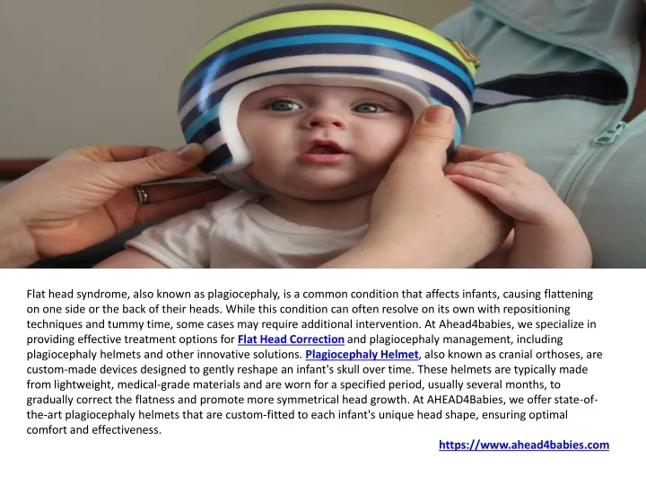 flat head syndrome also known as plagiocephaly