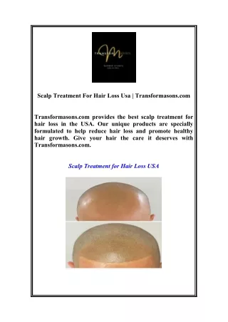 Scalp Treatment For Hair Loss Usa | Transformasons.com