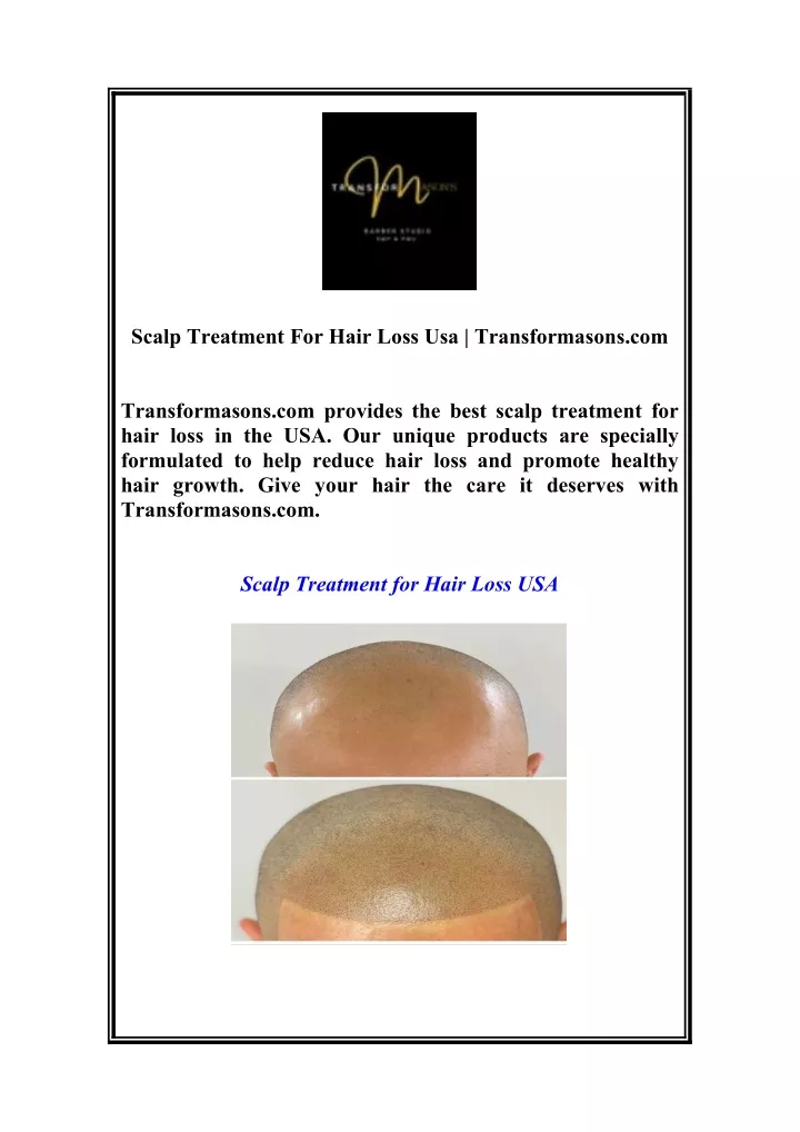 scalp treatment for hair loss usa transformasons