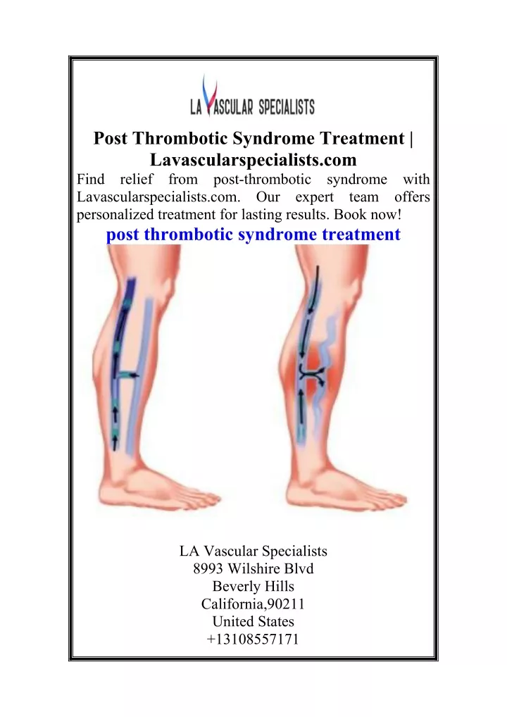 post thrombotic syndrome treatment