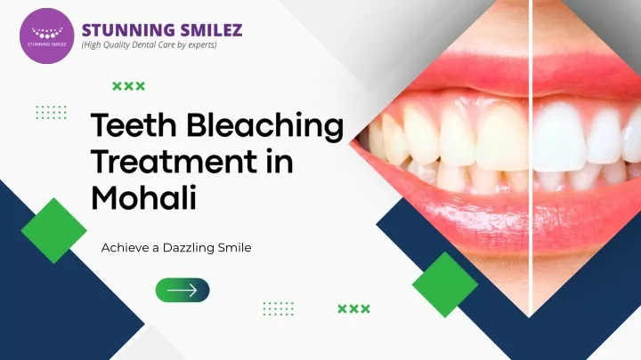 teeth bleaching treatment in mohali