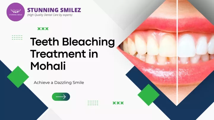 achieve a dazzling smile