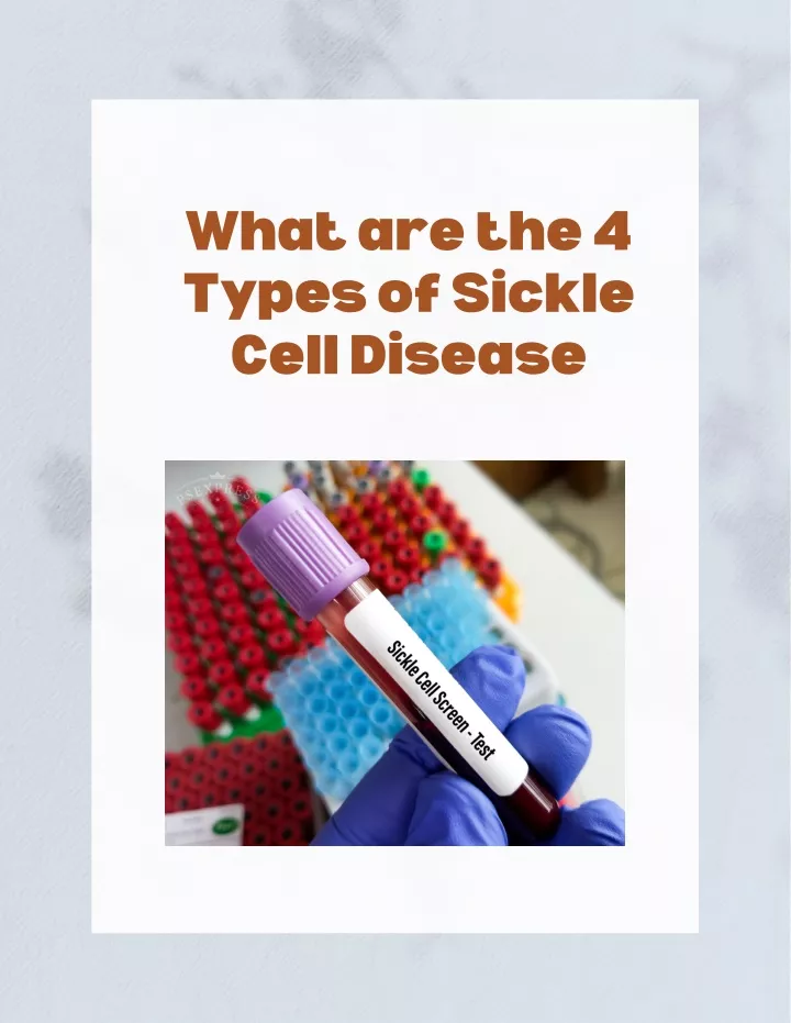 what are the 4 types of sickle cell disease