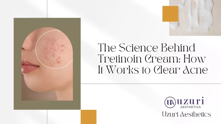 the science behind tretinoin cream how it works