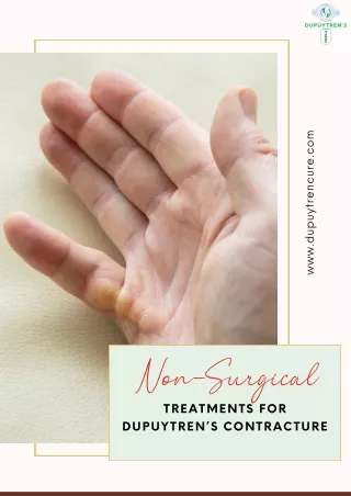 Latest Non-Surgical Treatments for Dupuytren’s Contracture