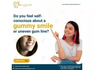 Treatment for Gummy Smile in Chandigarh | Lifecare Dental Clinic