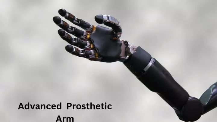 advanced prosthetic arm