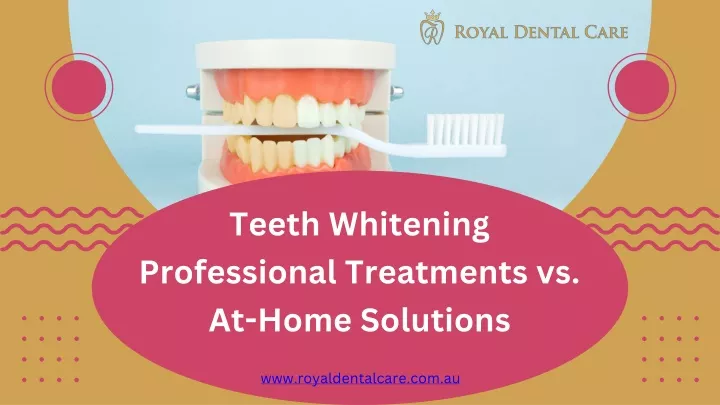 teeth whitening professional treatments