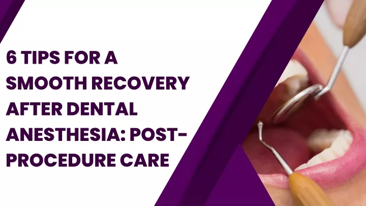 6 tips for a smooth recovery after dental