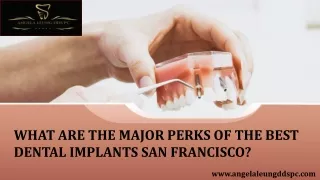The Best Dental Implants San Francisco