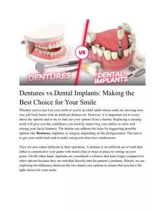 Dentures vs.Dental Implants_ Making the Best Choice for Your Smile