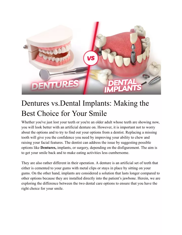 dentures vs dental implants making the best