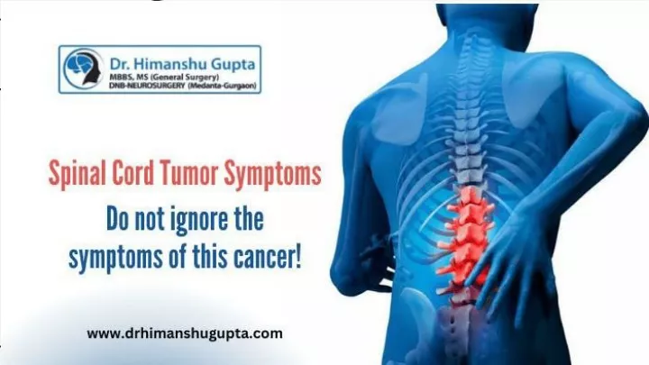 recognizing spinal cord tumor symptoms