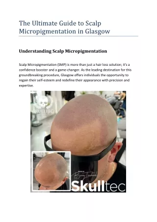 The Ultimate Guide to Scalp Micropigmentation in Glasgow