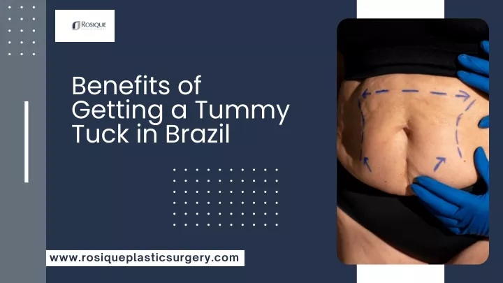 benefits of getting a tummy tuck in brazil