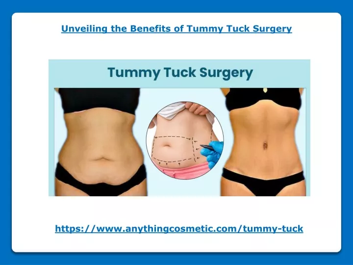 unveiling the benefits of tummy tuck surgery