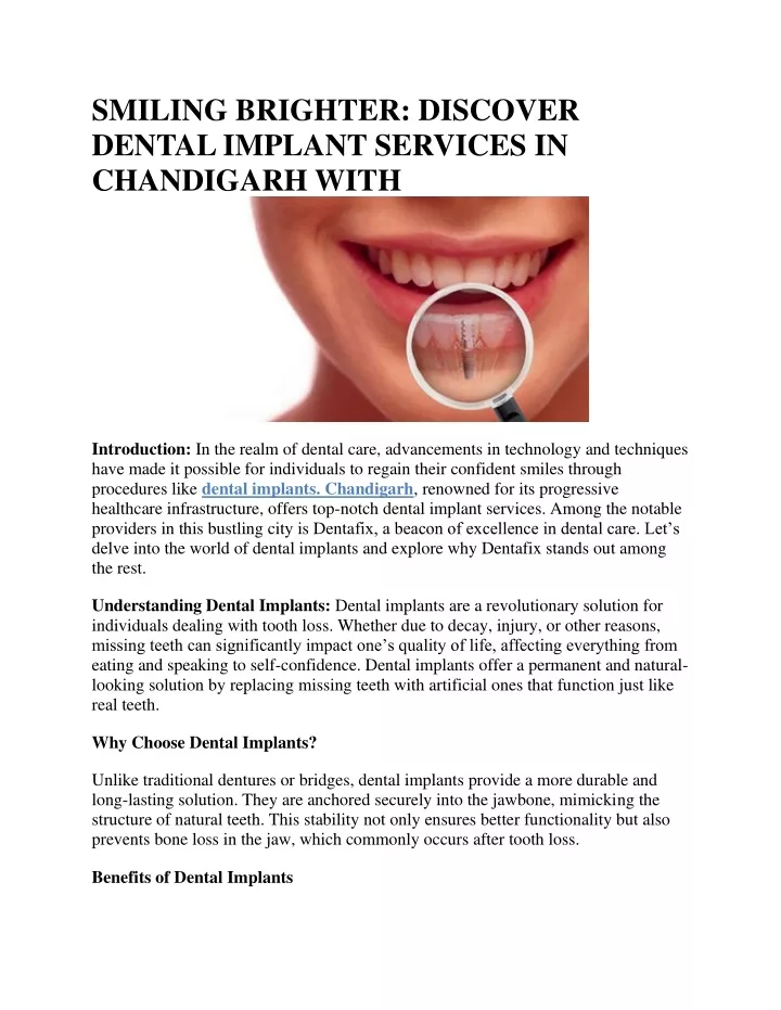smiling brighter discover dental implant services