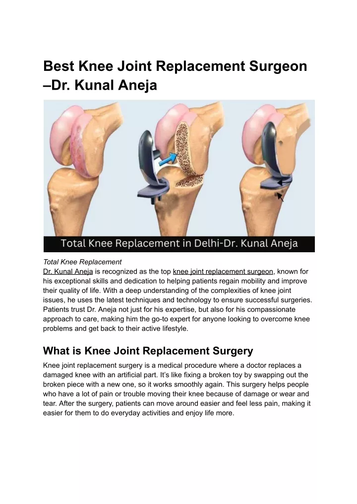 best knee joint replacement surgeon dr kunal aneja