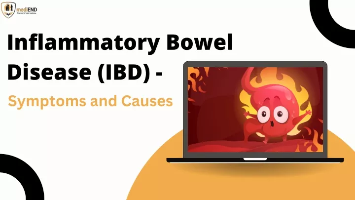 Ppt Inflammatory Bowel Disease Ibd Symptoms And Causes Powerpoint Presentation Id 13091770