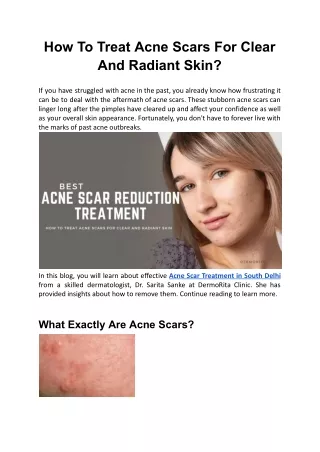 How To Treat Acne Scars For Clear And Radiant Skin