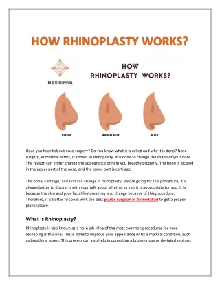 HOW RHINOPLASTY WORKS