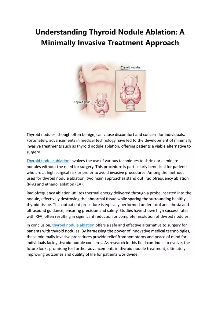 understanding thyroid nodule ablation a minimally