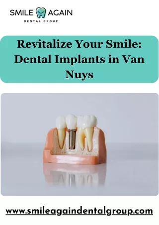 Revitalize Your Smile: Dental Implants in Van Nuys