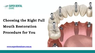 Choosing the Right Full Mouth Restoration Procedure for You