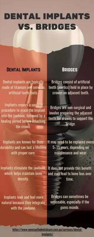 Dental Implants vs. Bridges