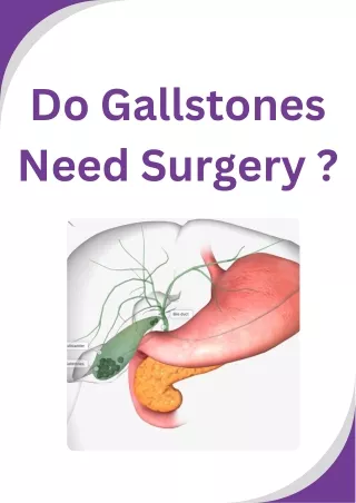 Do Gallstones Need Surgery ?
