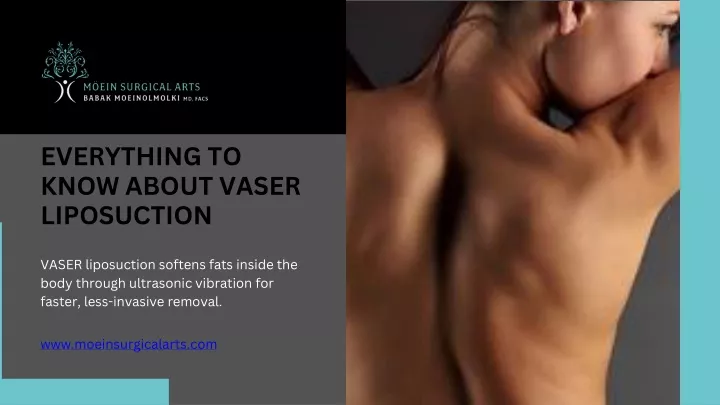 everything to know about vaser liposuction