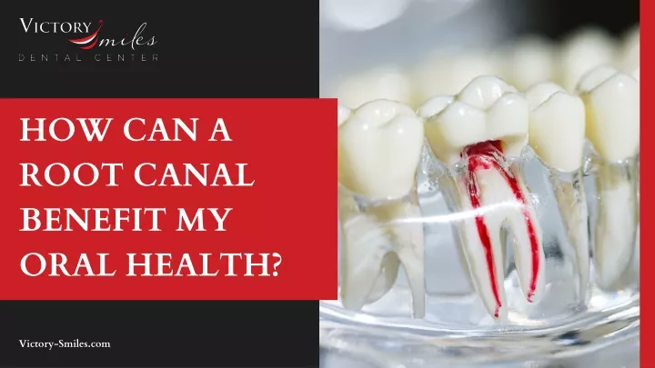 how can a root canal benefit my oral health