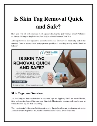 Is Skin Tag Removal Quick and Safe