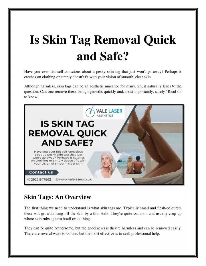 is skin tag removal quick and safe