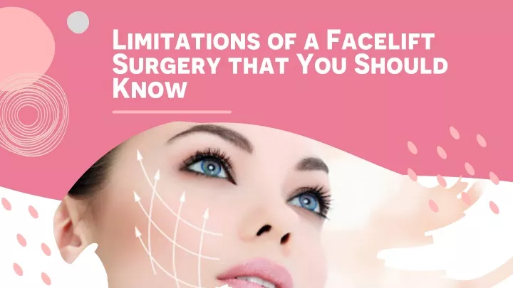 limitations of a facelift surgery that you should